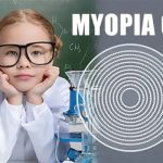 مایوپیا کنترل دکتر توکلی