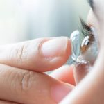 لنز اسکلرال دکتر توکلی